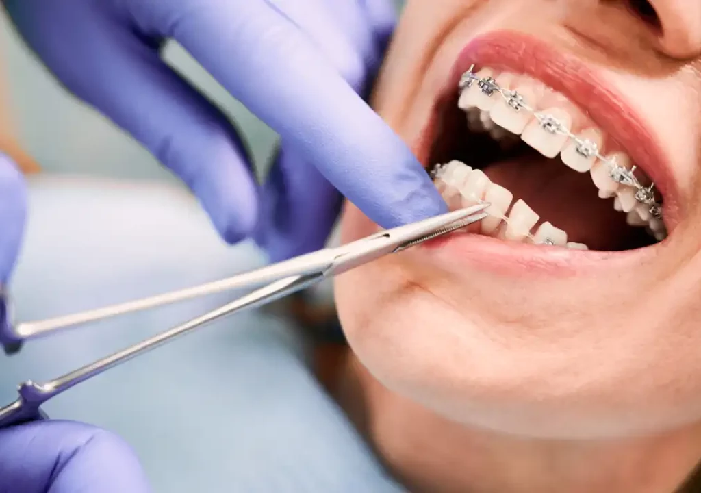 Lane Cove Orthodontics
